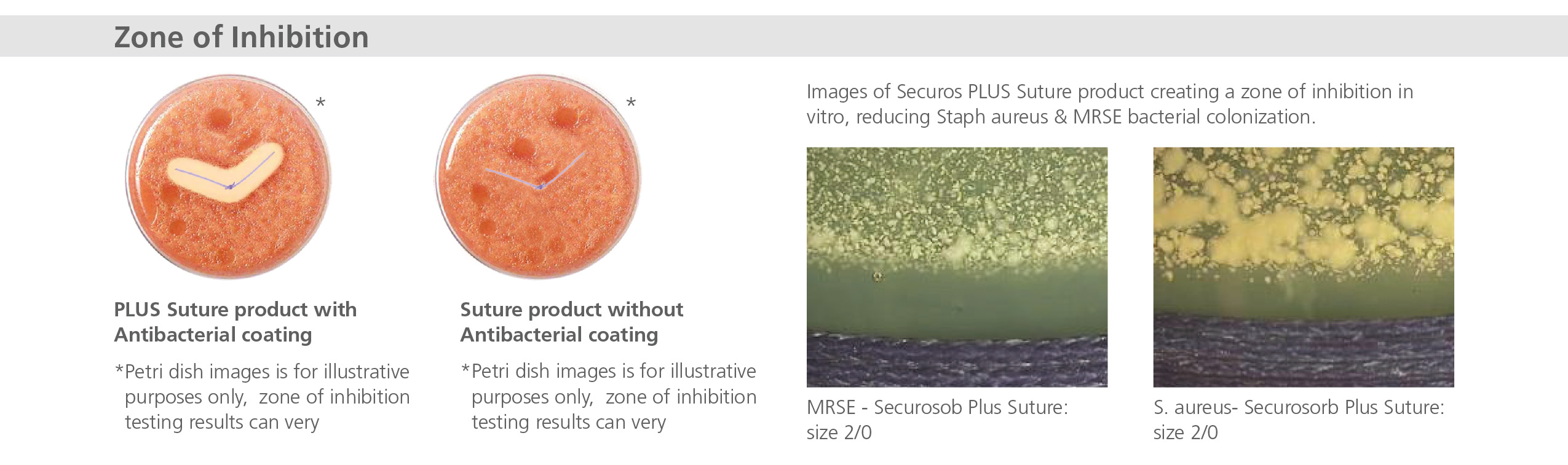 securos zone inhibition