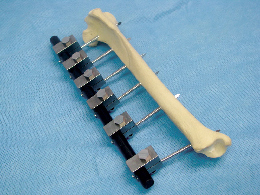 ESF Bone model on a table